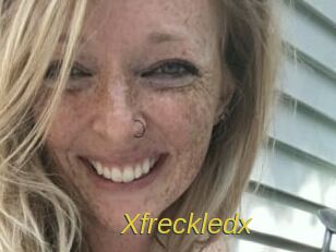 Xfreckledx